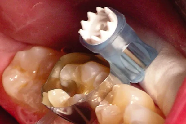 Maximat Plus Pre-Loaded - 0.04mm 6.3mm (5124)